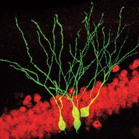 New insights on new neurons