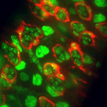 Fruit fly bodies bank stem cells