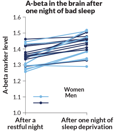 The brain may clean out Alzheimer's plaques during sleep