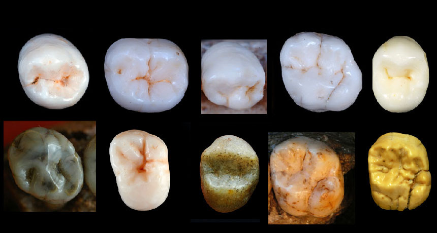 humans with multiple rows of teeth