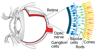 A gene-based therapy partially restored a blind man's vision