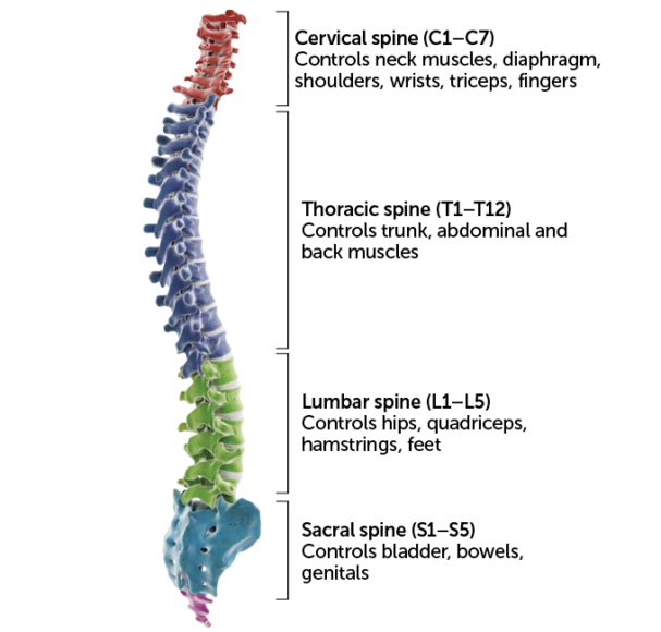 Spinal stimulation gives some people with paralysis more freedom