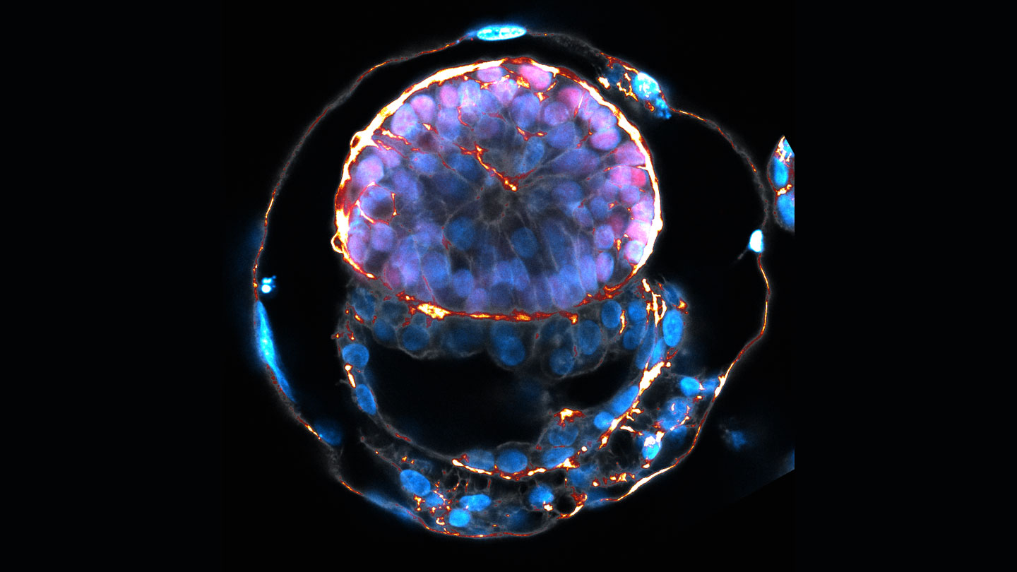 Everything you should know about the increasing complexity of human embryo replicas