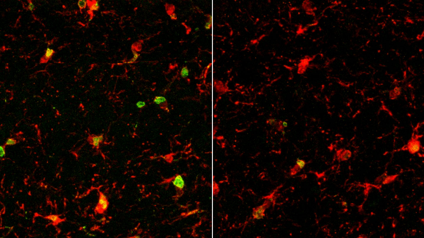 The Same Protein May Enable Three Methods of Rejuvenating Aging Brains