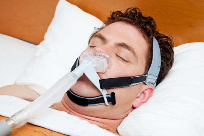 A photo of a white man lying in bed with a CPAP machine strapped to his head and covering his nose.